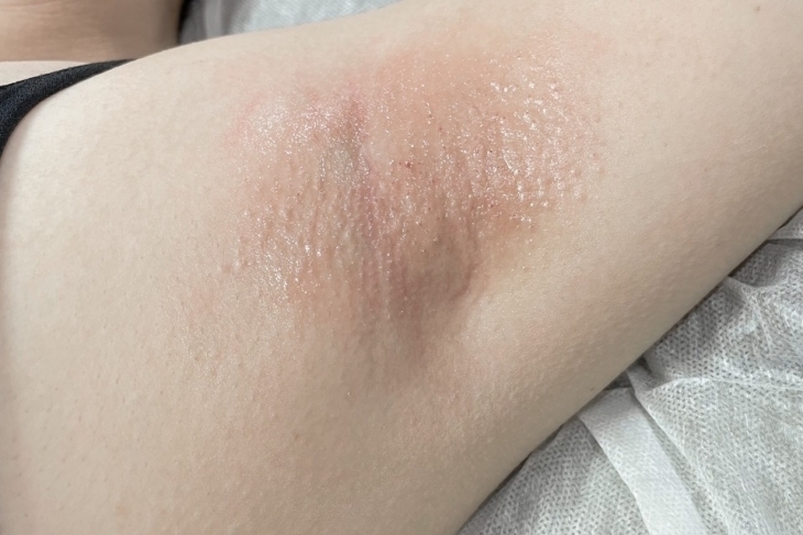 Mini Beauty 米粒美學