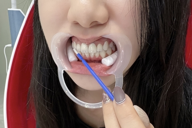 ATTRACTION DR. 亮白專家