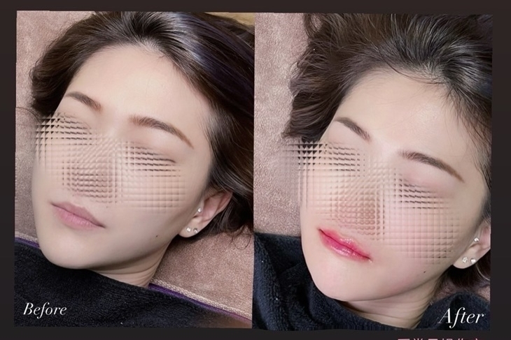 MATnail藝術美甲｜美睫｜半永久眉眼唇定妝