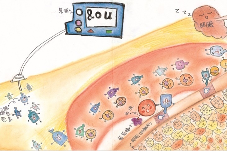 抗糖小勇士繪本募資計畫