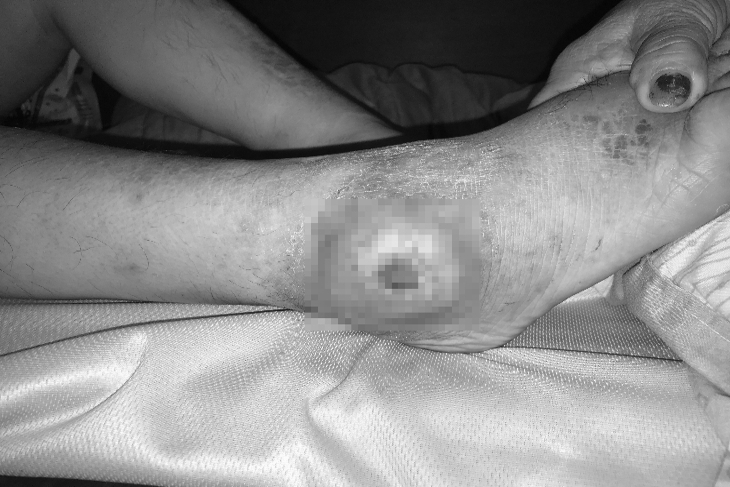 雙北長者傷口照護計畫