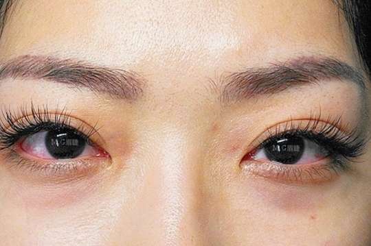 Mego 美睫 臉部撥筋