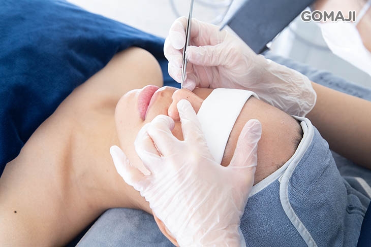 黑頭粉刺手工清潔