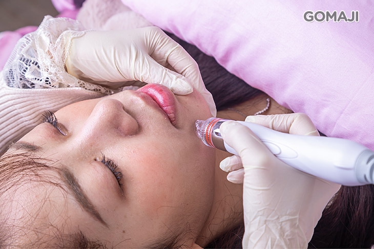 小氣泡代謝毛孔內皮脂及老廢角質