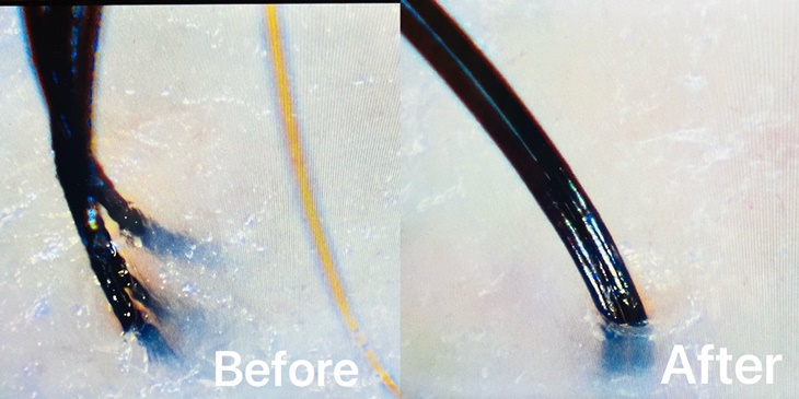 客製化頭皮髮質養護