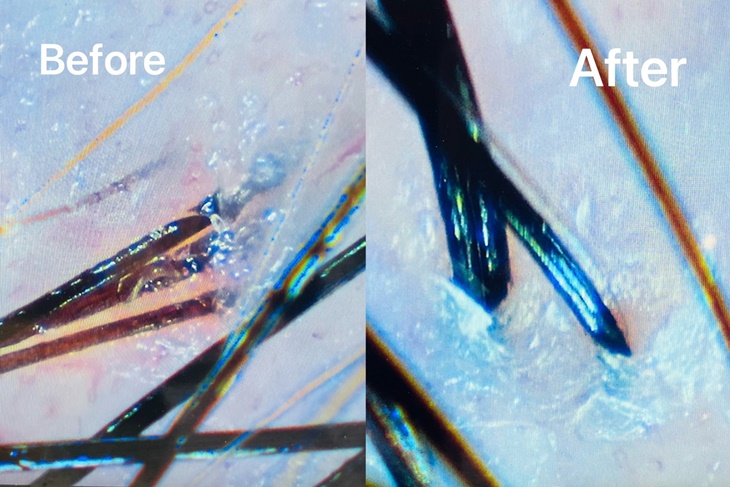 客製化頭皮髮質養護