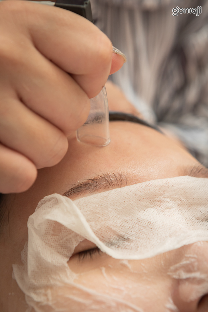 手工清除毛孔粉刺痘痘調理(依原生膚況客製化調整)