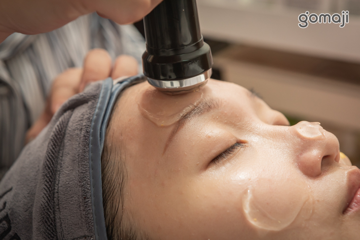 高分子玻尿酸導入肌底