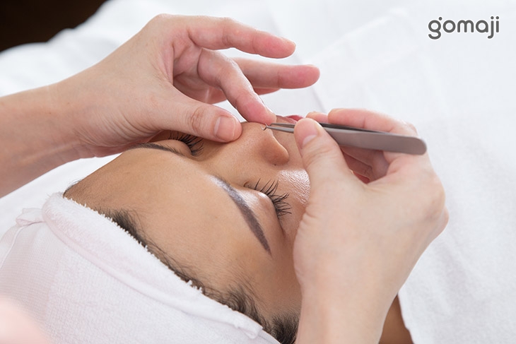 粉刺清痘淨化調理