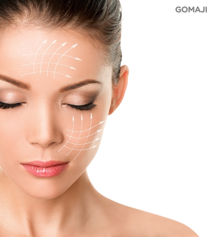 RF激活煥膚提拉