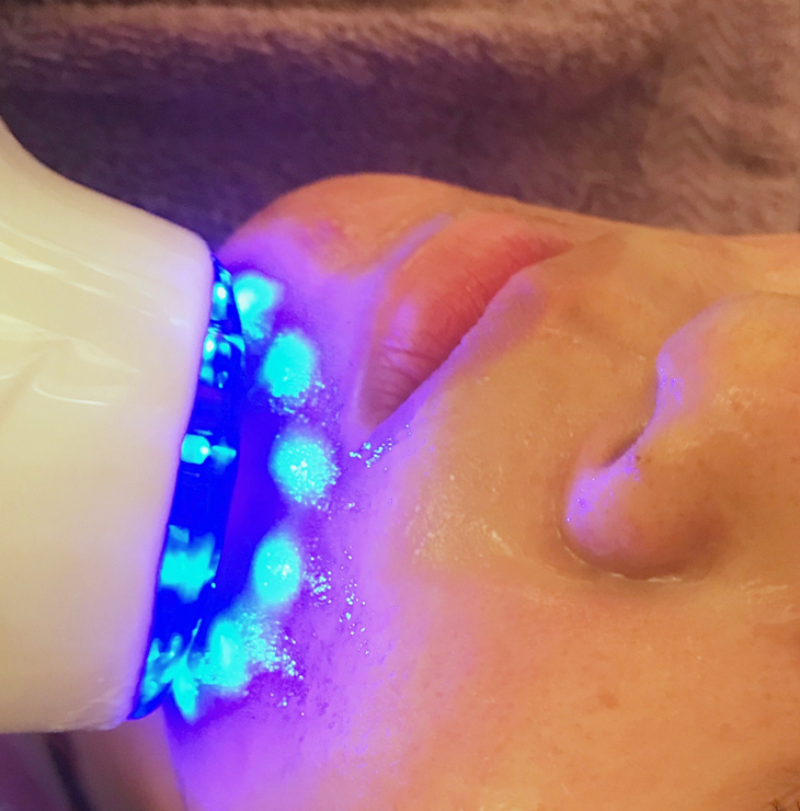 冰晶緊緻毛孔冰導澳洲原裝Healthy Care彈力精靈高濃縮膠原蛋白原液安瓶導入