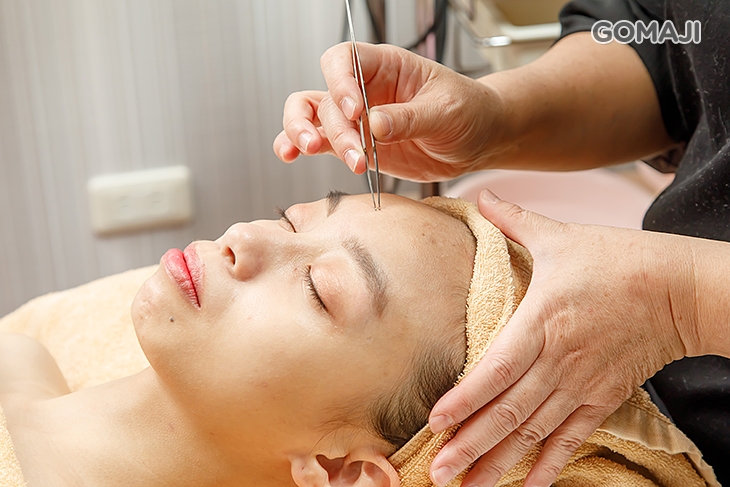 全臉粉刺痘痘手工淨化