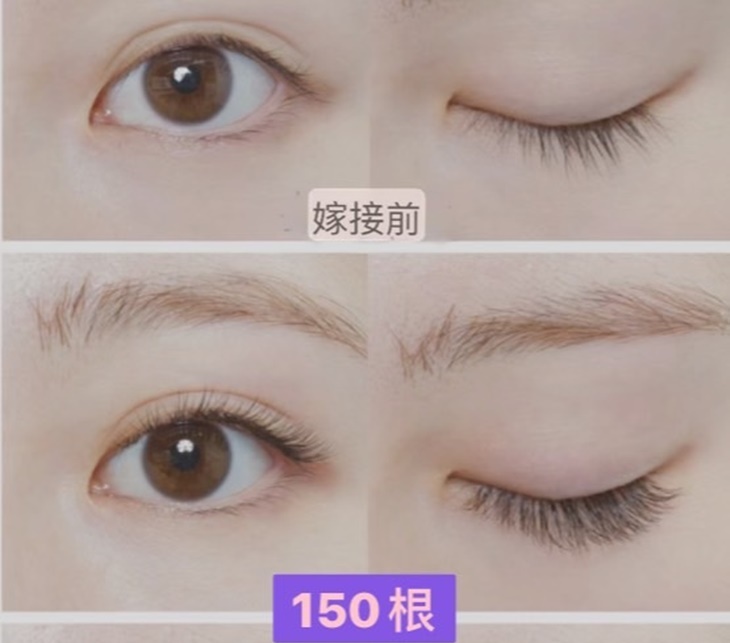 睫毛嫁接