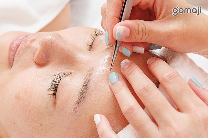 專業美容師粉刺痘痘技術淨化處理