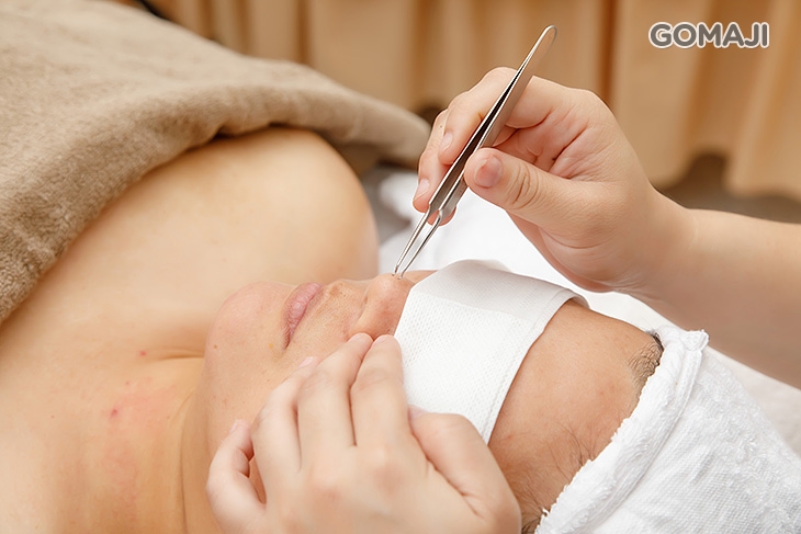 痘痘黑頭粉刺淨化清潔(依個人膚況而定)