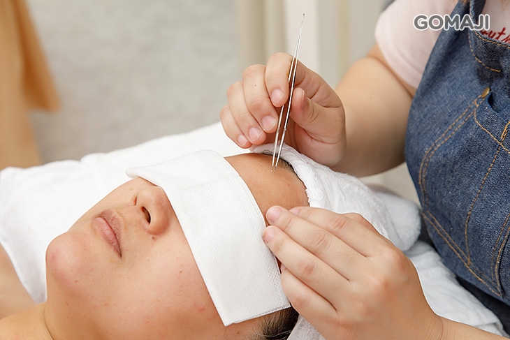 痘痘黑頭粉刺淨化清潔(依個人膚況而定)