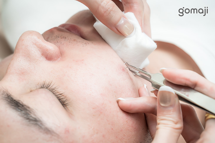 A.速效深層毛孔淨化！手工清粉刺&淨痘護理全程45分(手技45分)