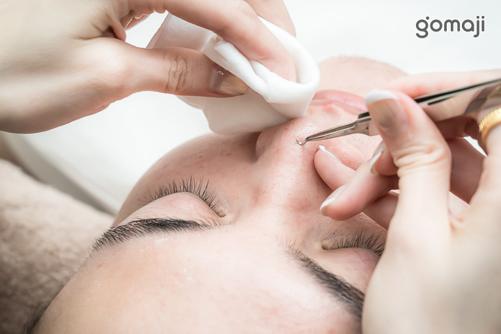 A.速效深層毛孔淨化！手工清粉刺&淨痘護理全程45分(手技45分)