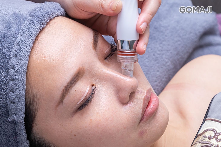 水飛梭皮膚管理