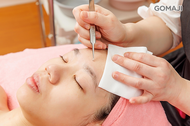 手工粉刺痘痘毛孔清理