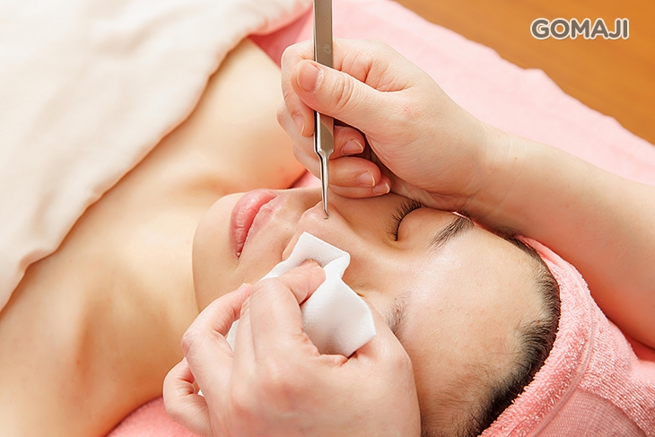 手工粉刺痘痘毛孔清理