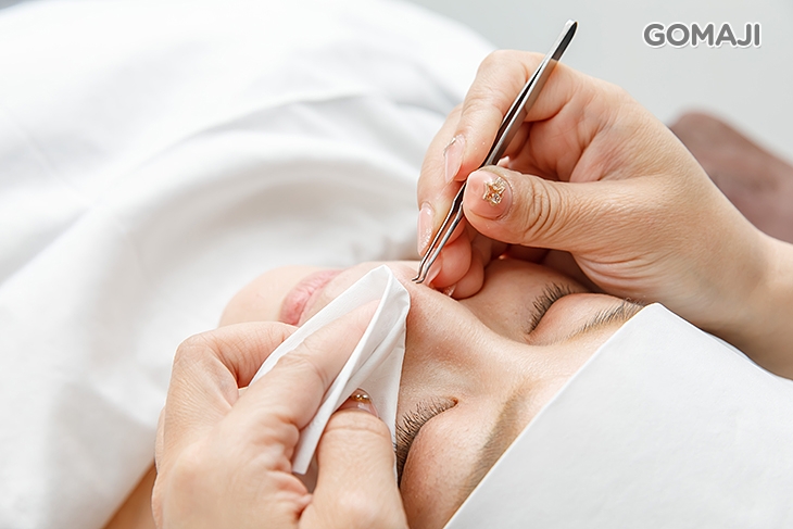 光子親膚粉刺調理