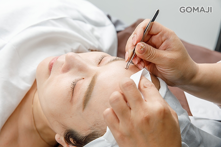 光子親膚粉刺調理