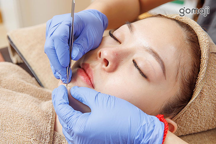 獨特輕柔手工清粉刺