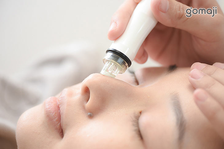 小氣泡粉刺痘痘淨化