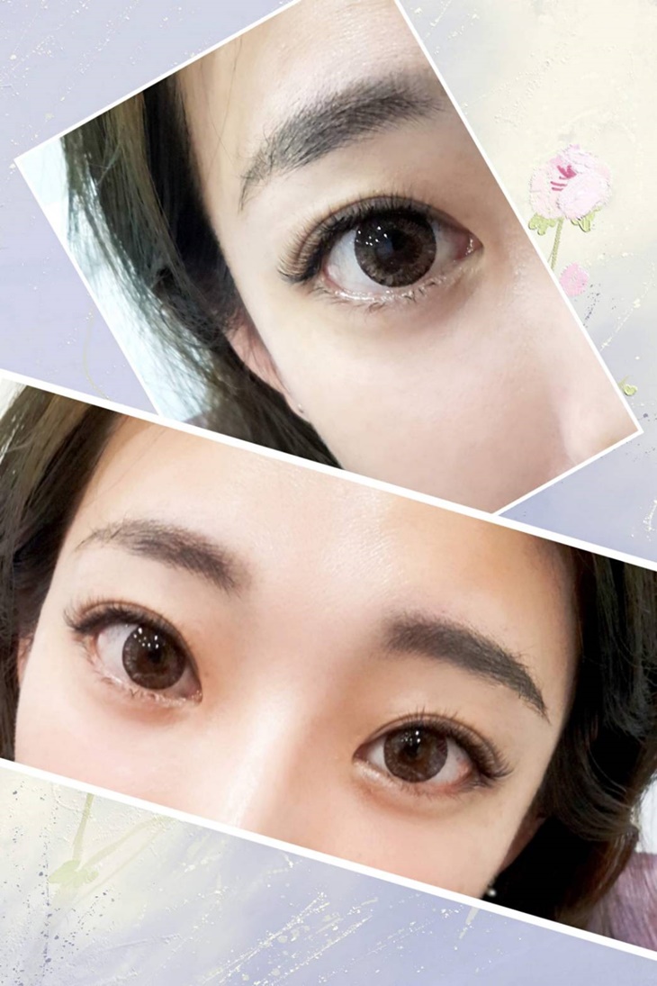 睫毛嫁接