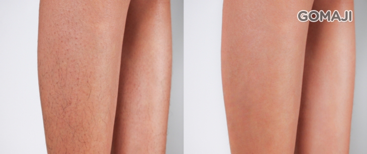 義式溫熱蠟手工除毛