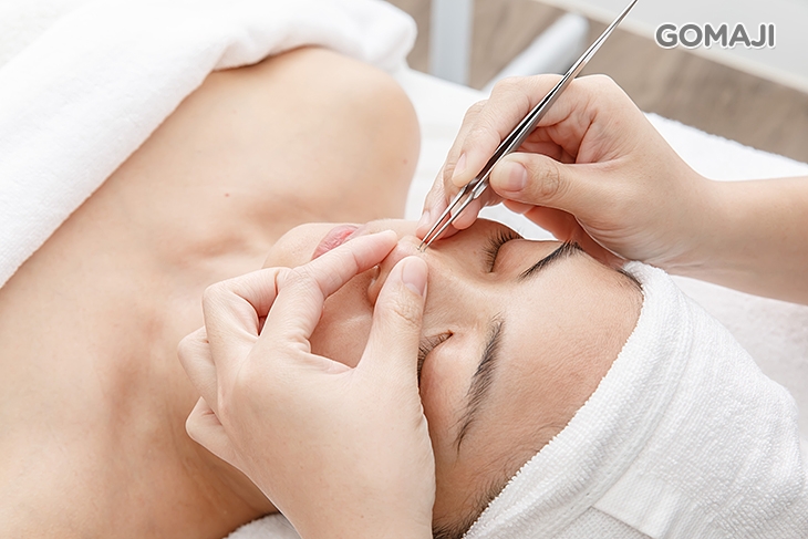 高透氧粉刺痘痘清潔