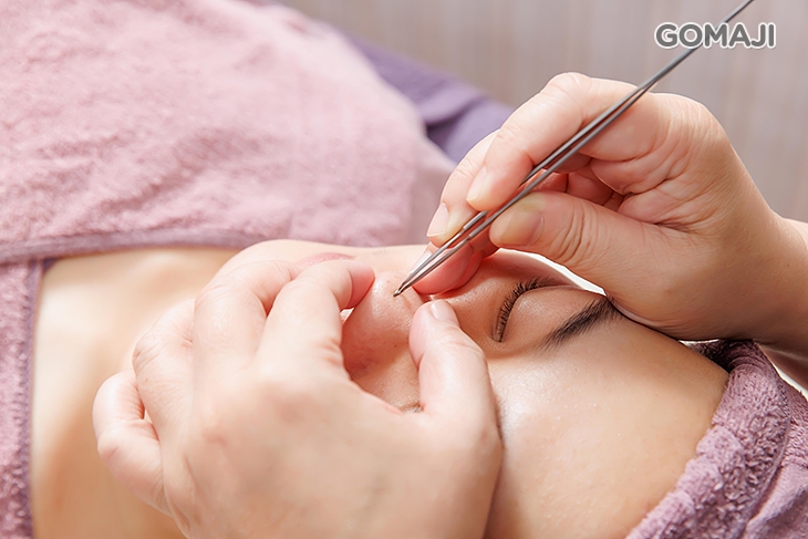 全臉黑頭粉刺痘痘淨化清除(依個人膚況而定)