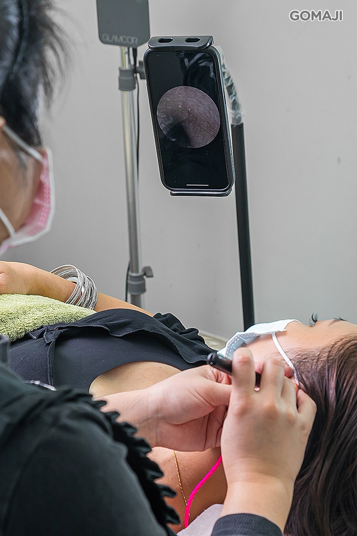 內視鏡耳道檢查