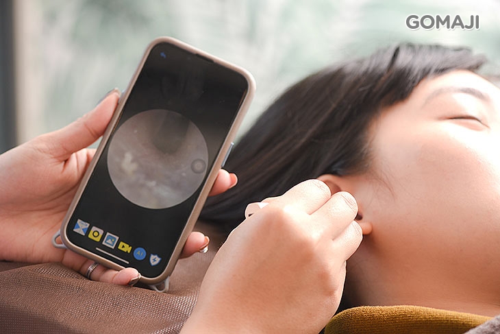 耳道內視鏡檢查