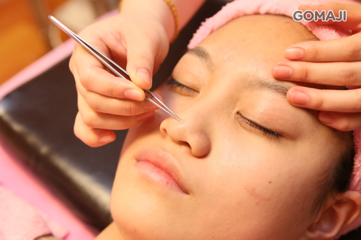 全臉黑頭粉刺痘痘清潔(依個人膚況而定)