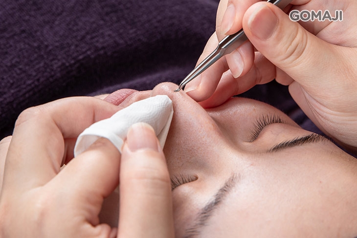 全臉手工專業粉刺淨化