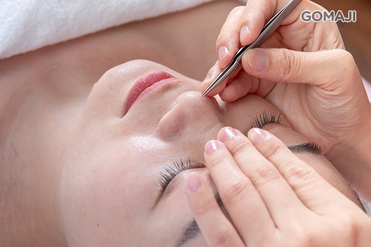  全臉粉刺痘痘處理 