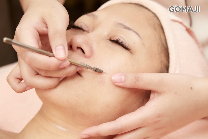 加贈超微波解垢儀-無痛無痕清粉刺