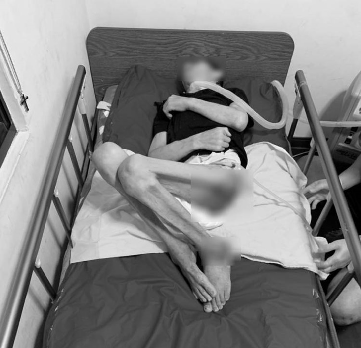 新竹偏鄉重癱患者營養奶粉捐助