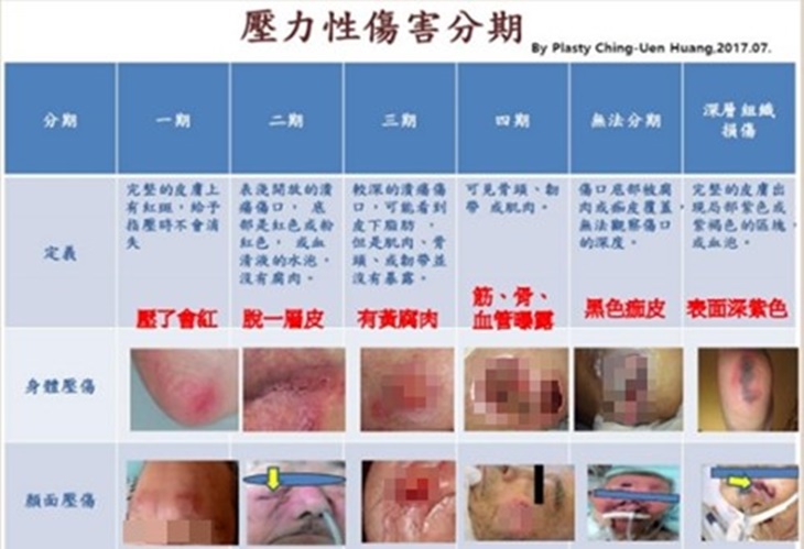 北部慢性傷口患者照護計畫