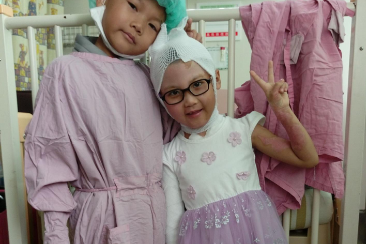 社團法人中華民國兒童燒燙傷關懷協會