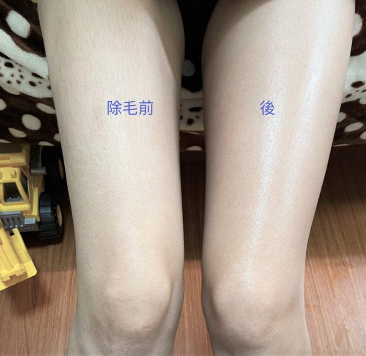 細緻光滑手腿部熱蠟除毛