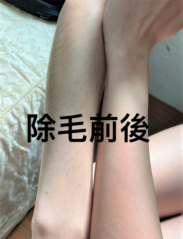 細緻光滑手腿部熱蠟除毛