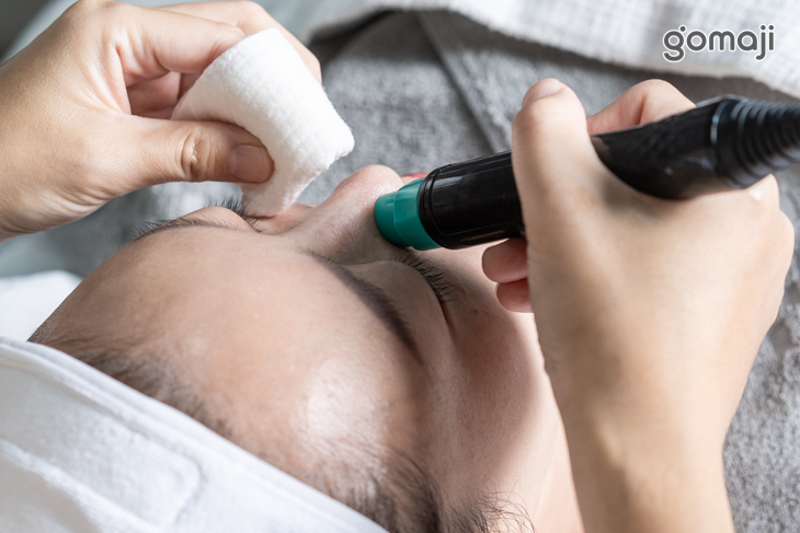 韓國淨膚小氣泡