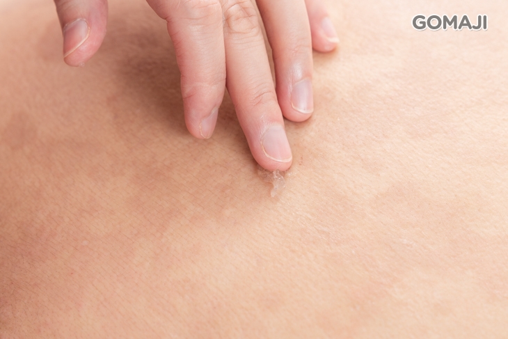 雪肌美人角質代謝更新