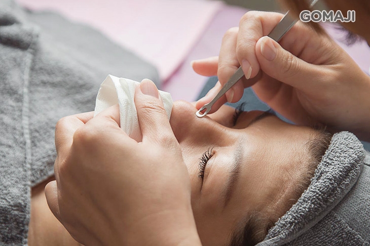 手工黑頭粉刺痘痘淨化毛孔