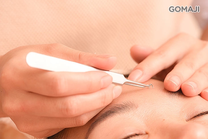 重點黑頭粉刺痘清潔(依個人膚況而定)