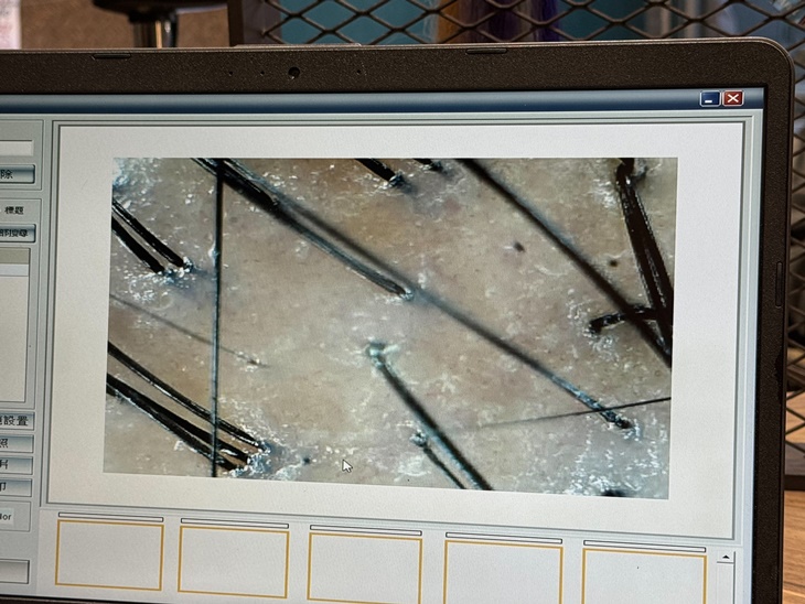 C.頭皮是好髮質根源！ATS系列深層頭皮管理