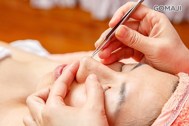 專業手工技術粉刺痘痘調理